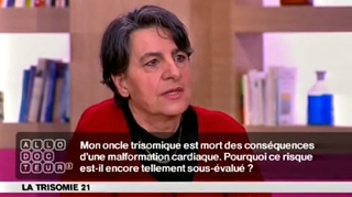 Trisomie 21 et malformations cardiaques : quelle prise en charge ?