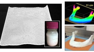 Imprimer en 3D des implants osseux résorbables