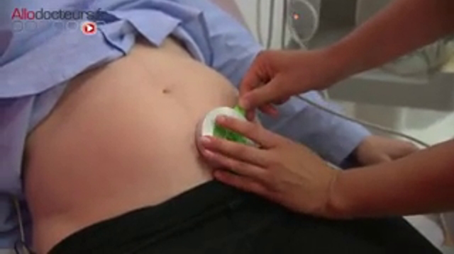 Des pacemakers adaptés pour les bébés