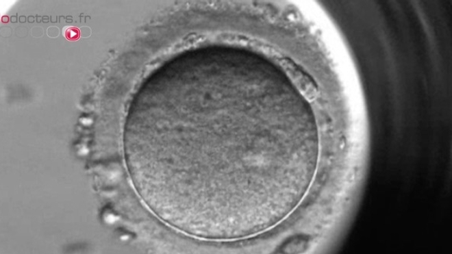 Un embryoscope (image d'illustration)