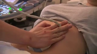 Trisomie 21 : un test d'ADN foetal pour éviter l'amniocentèse
