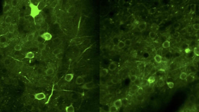 Activité neuronale dans le cortex préfrontal de contrôle (à gauche) et dans un cortex exprimant la mutation humaine CHRNA5 (à droite). Crédits : Institut Pasteur (https://youtu.be/NE3-AFRoMM4).
