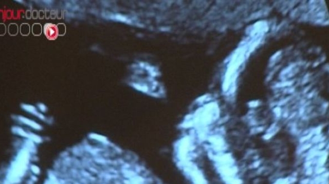 La formation du visage humain d'un embryon en 30 secondes