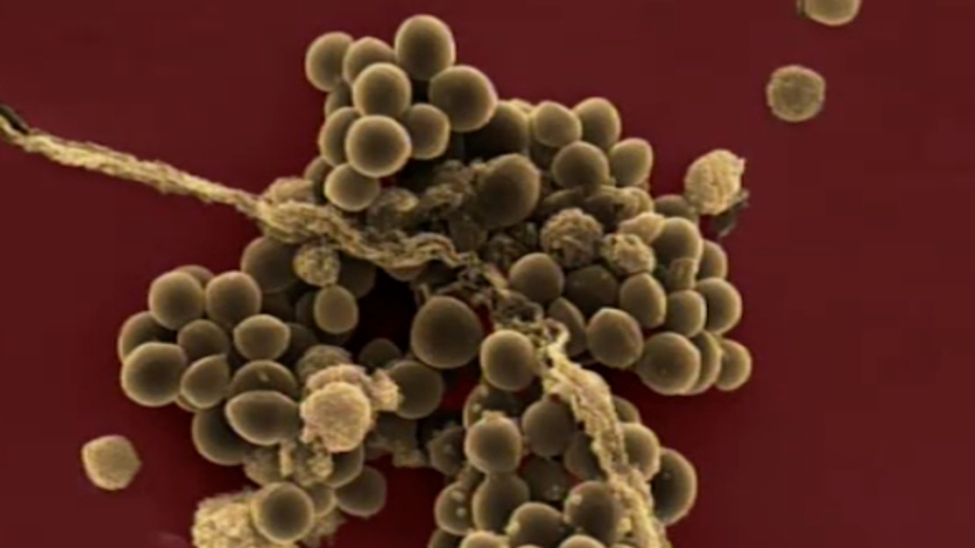 Staphylocoque doré : une bactérie sous surveillance - AlloDocteurs