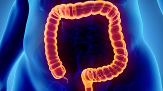 Cancer colorectal : un dépistage encore insuffisant