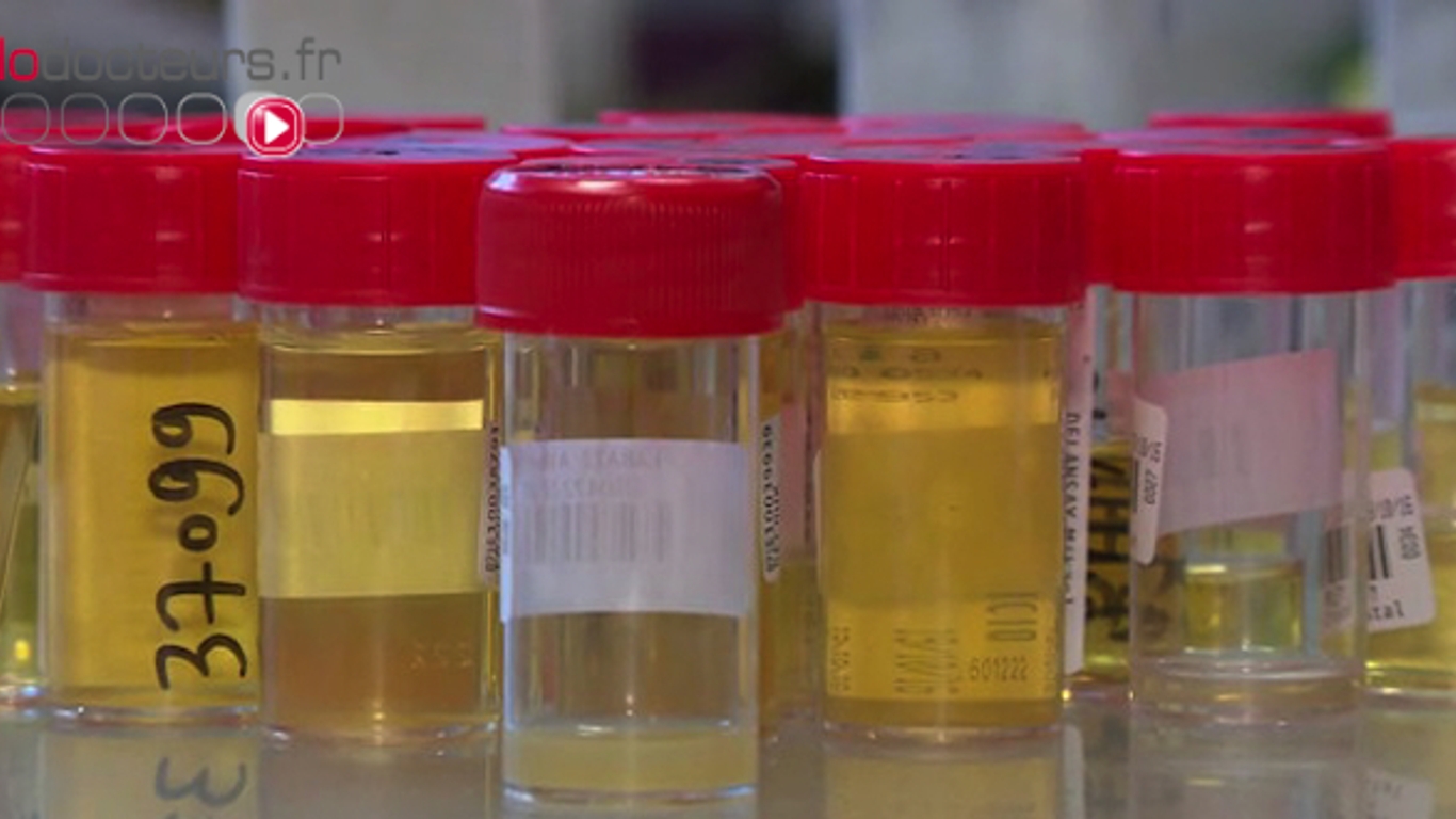 L Urine Des Vertus Moins Connues Allodocteurs L Urine Des Vertus Moins Connues Allodocteurs