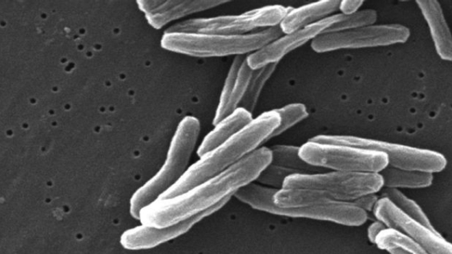 Tuberculose : l'efficacité des nouveaux traitements doit être préservée