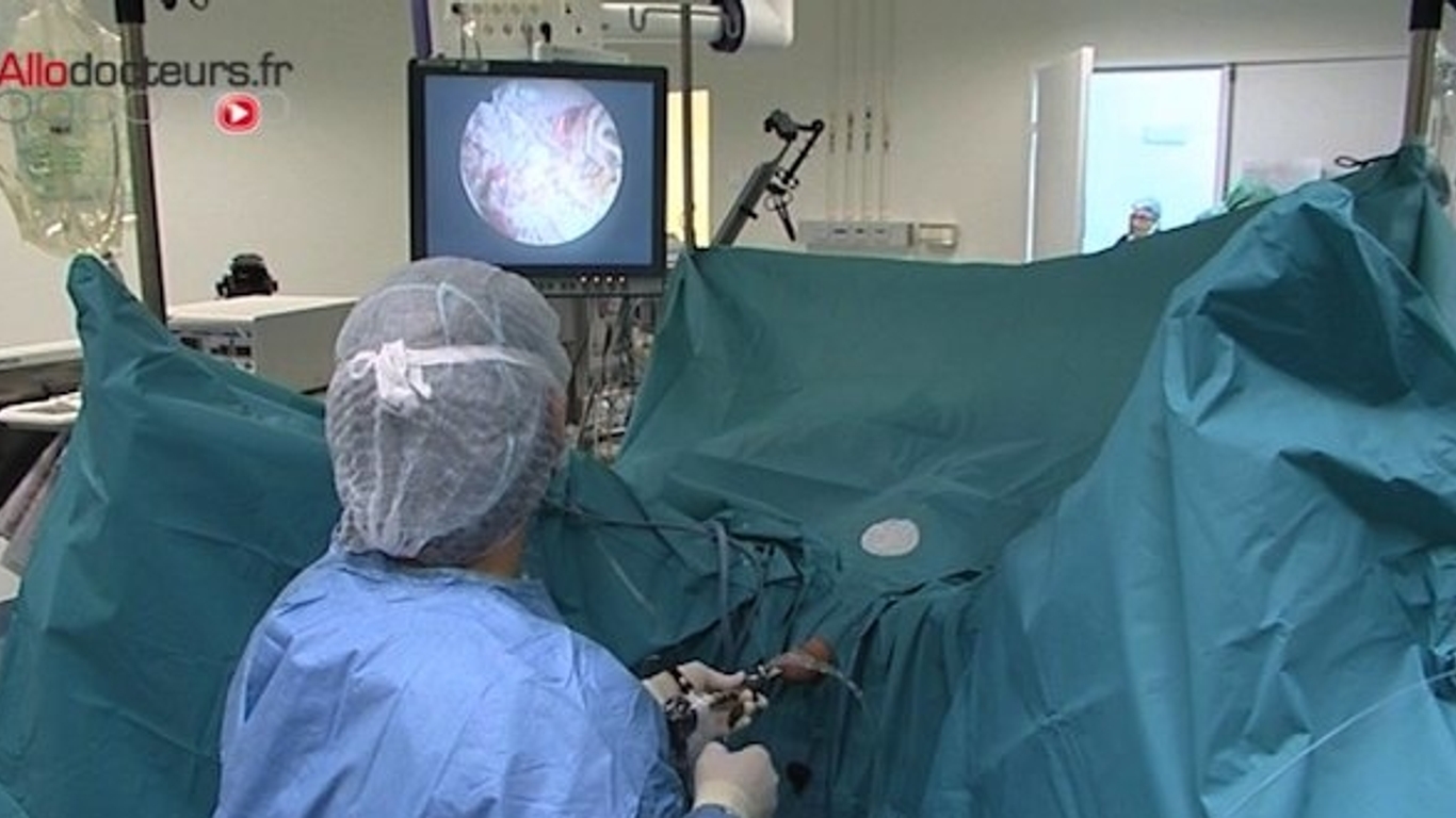 Ablation de la prostate et dysfonction sexuelle ni systématique, ni irreversible AlloDocteurs