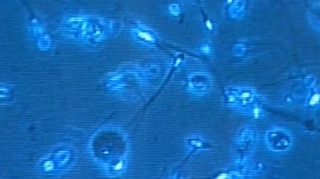 Des cellules de la peau génèrent des spermatozoïdes