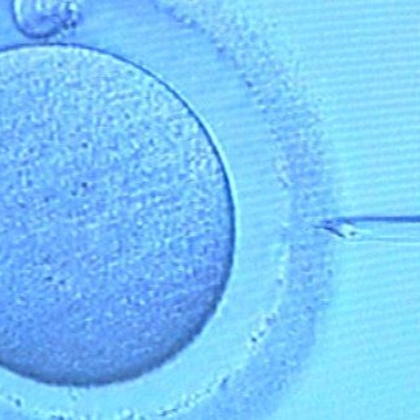 Révision de la loi bioéthique : la question des recherches autour de la reproduction