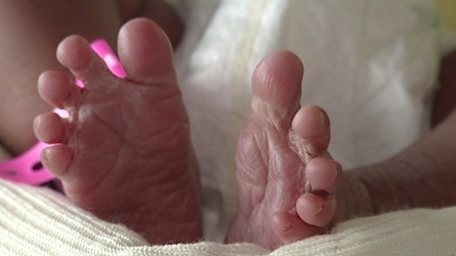 Le plus petit bébé au monde est sorti de l’hôpital