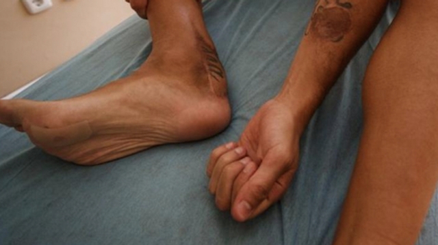 Foot : blessé à la cheville, une bactérie lui ronge le tendon d’Achille