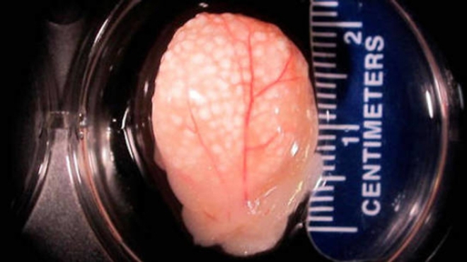 Des ovaires artificiels. © Wake Forest Institute for Regenerative Medicine