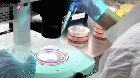 La greffe de cellules souches pour réparer les fistules anales 