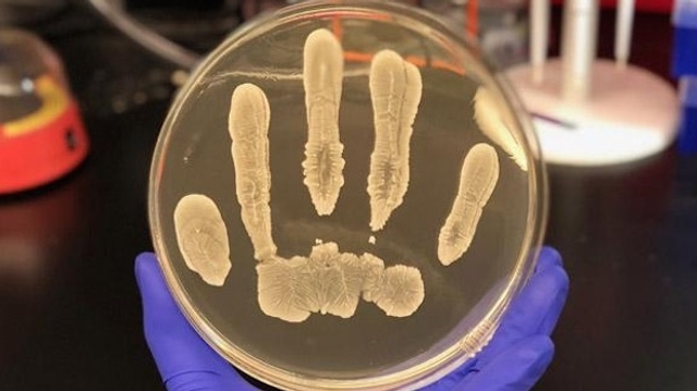 Sur notre peau, des bactéries qui combattent le cancer ?