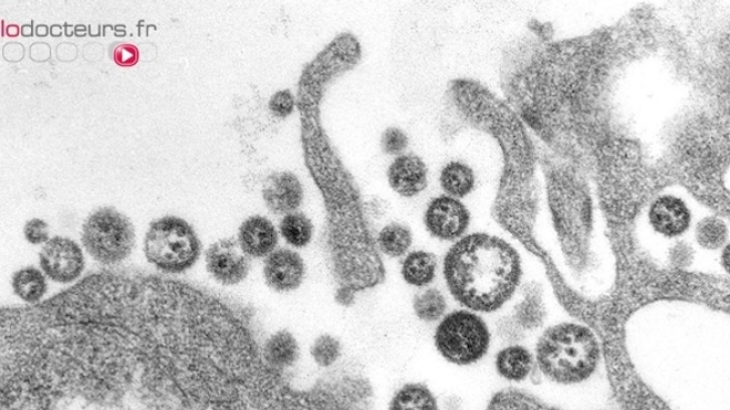 Fièvre de Lassa : une épidémie sans précédent au Nigeria