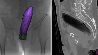 Un Japonais se retrouve aux urgences avec une aubergine… dans le rectum