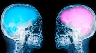 Le cerveau des hommes et celui des femmes sont-ils différents ?