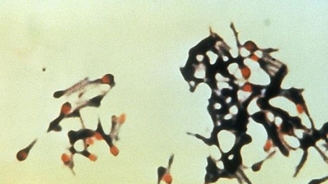 Clostridium tetani (crédit photo : CDC)