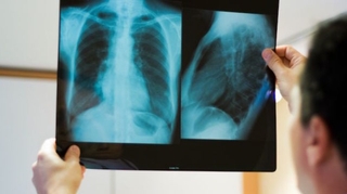 Imagerie médicale : l'exposition des enfants aux radiations a baissé en cinq ans