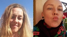 #EggHeadChallenge : elles montrent leur crâne chauve pour sensibiliser au cancer