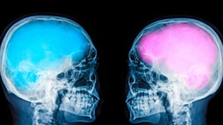 Les cerveaux féminins vieilliraient moins vite que les cerveaux masculins