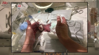 Japon : il naît à 268 grammes et sort de l’hôpital cinq mois plus tard en bonne santé