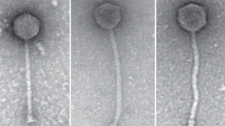 Infection bactérienne : une jeune fille sauvée grâce à des phages