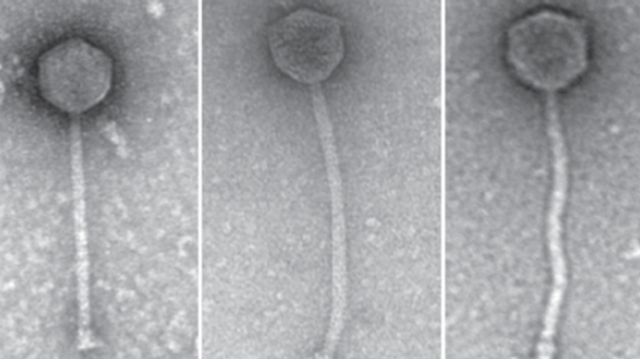Infection bactérienne : une jeune fille sauvée grâce à des phages