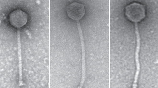 Les trois phages utilisés contre l'infection bactérienne d'Isabelle Carnell-Holdaway.