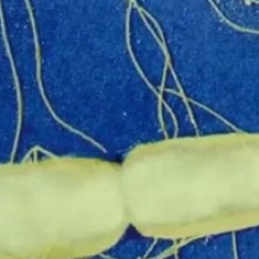 La salmonelle, souvent à l'origine des gastro-entérites