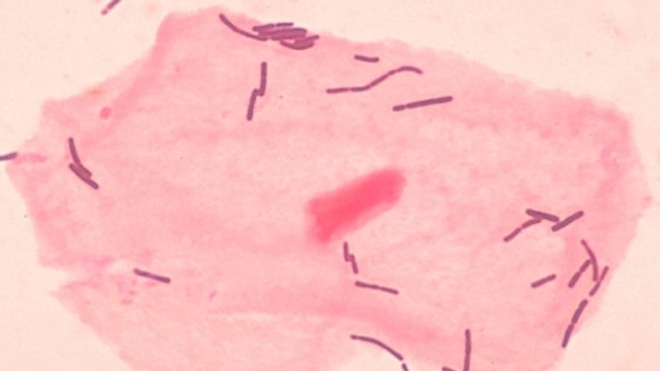 Cellule épithéliale du vagin et bactéries lactobacilles.