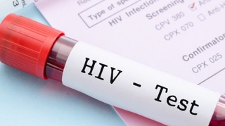 Traitement et prévention du VIH, quoi de neuf ?