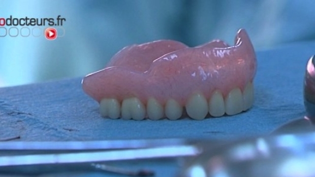 Il avale sa prothèse dentaire pendant une opération