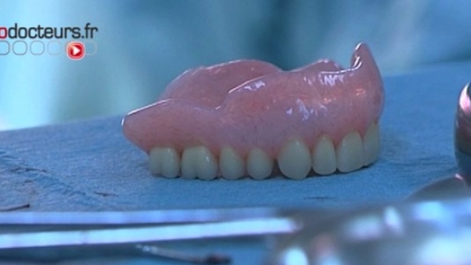 Le patient pensait avoir perdu sa prothèse dentaire