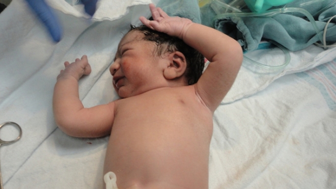 Les bébés nés par césarienne produisent deux fois moins d'anticorps suite à un vaccin