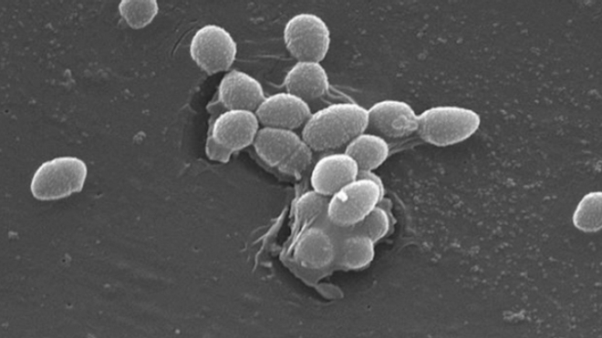 Recrudescence d’une bactérie très résistante aux antibiotiques près de Foix