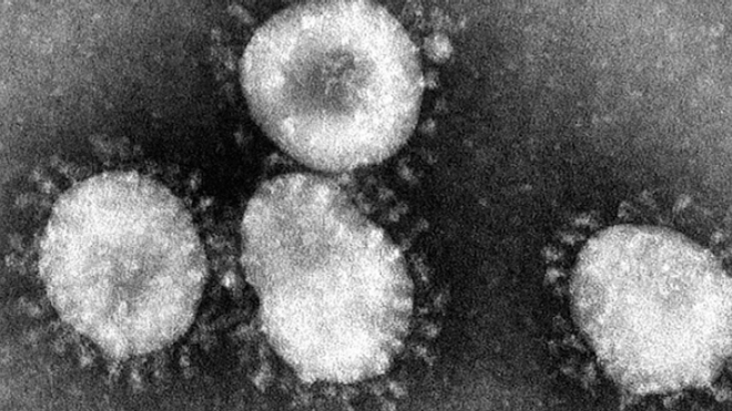 Coronavirus : deux nouveaux décès de médecins dans le Grand est