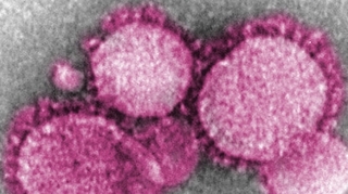 Un quatrième cas en France de coronavirus, l’épidémie dépasse l’ampleur du SRAS