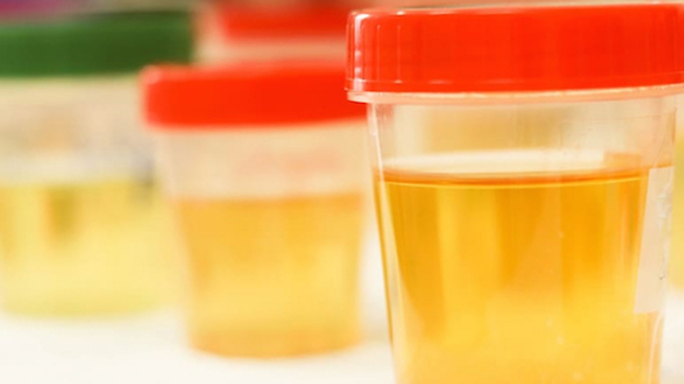 Les superpouvoirs de l'urine ! - AlloDocteurs