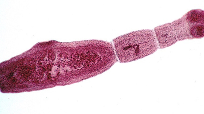 Echinococcus multilocularis au stade adulte. Son corps est composé de plusieurs anneaux. A droite : sa tête, qui comporte une ventouse et des crochets qui facilitent son accroche dans le tube digestif.