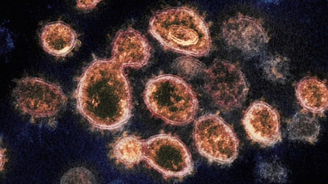 Coronavirus en France : 138 nouveaux cas supplémentaires, l'épidémie "inexorable"