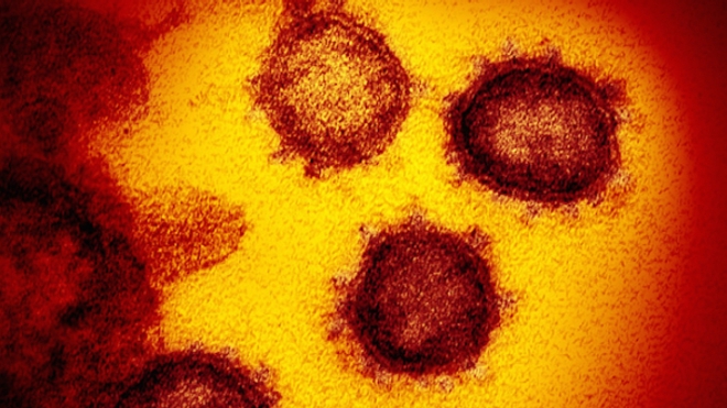 Coronavirus : un demi-million de morts et dix millions de cas de Covid-19 dans le monde
