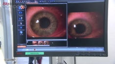 Les yeux, une autre porte d’entrée pour le coronavirus
