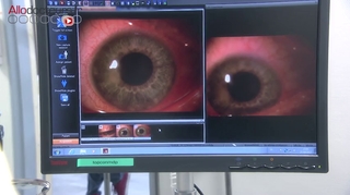 Les yeux, une autre porte d’entrée pour le coronavirus