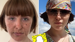 #SunFunNotSunBurn : un filtre Snapchat pour sensibiliser aux dégâts du soleil sur la peau