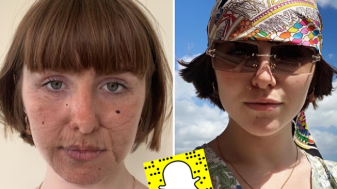 #SunFunNotSunBurn : un filtre Snapchat pour sensibiliser aux dégâts du soleil sur la peau