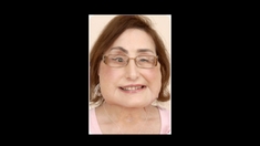 La première américaine greffée du visage est morte