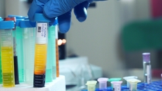 Le plasma, une efficacité limitée contre la Covid ?