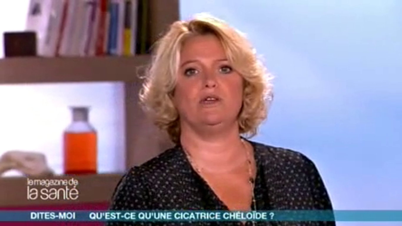 Qu’estce qu’une cicatrice chéloïde ? AlloDocteurs